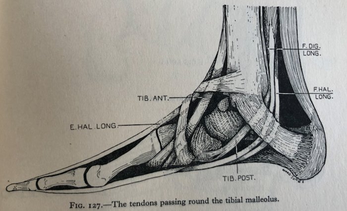 Tibialis posterior dysfunction — and why insoles need to be the right ones