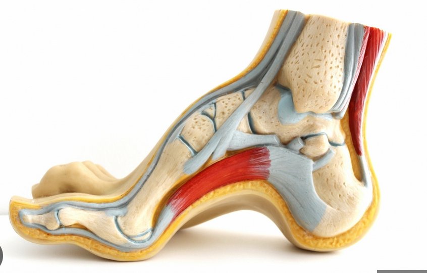 Custom insoles for unusual feet — a case study